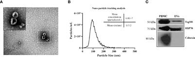 Characterization of MicroRNA Cargo of Extracellular Vesicles Isolated From the Plasma of Schistosoma japonicum-Infected Mice